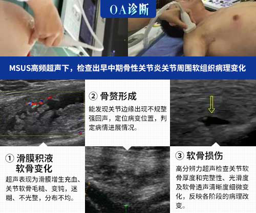 成都肌骨超声