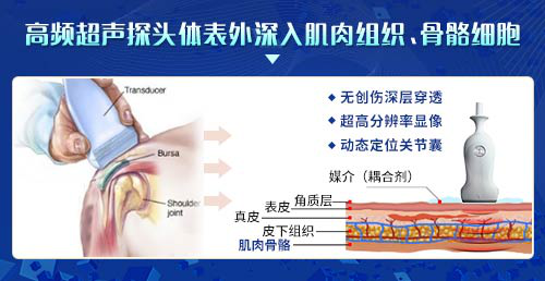 成都肌骨超声