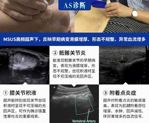 成都肌骨超声